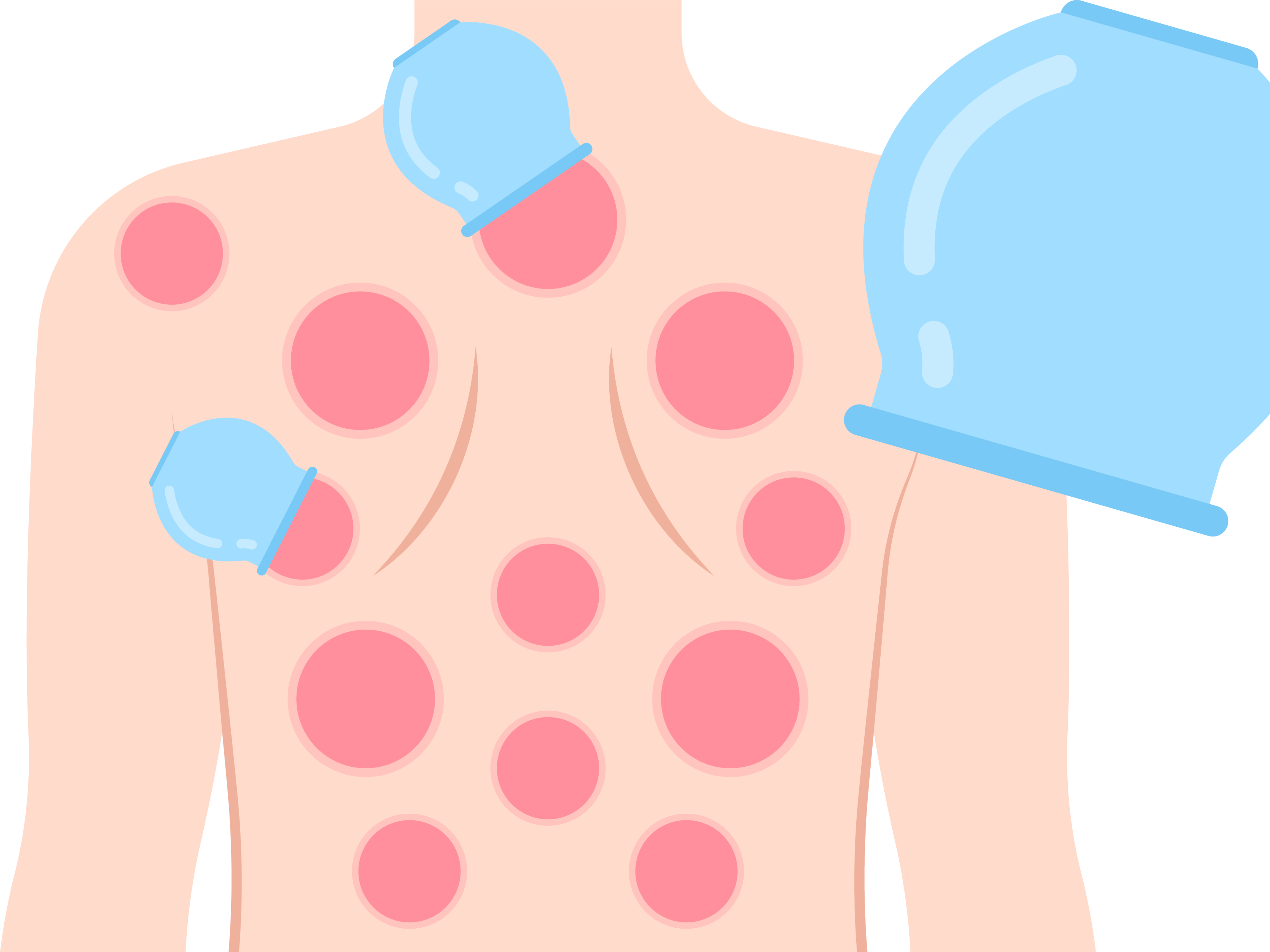 hijama